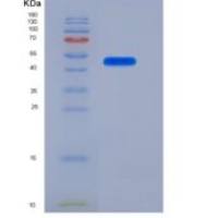 人LRP10重组蛋白His tag