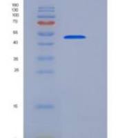 大鼠Layilin / LAYN重组蛋白Fc tag