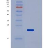 人CD32b / FCGR2B重组蛋白His tag