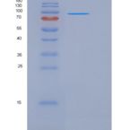 人NEL样蛋白2(NELL2)重组蛋白His tag