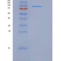 人NEL样蛋白2(NELL2)重组蛋白His tag