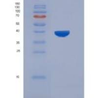 人OMGP / OMG重组蛋白aa 1-416, His tag