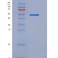 大鼠CD34分子(CD34)重组蛋白Fc tag