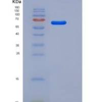 小鼠IL1R1 / CD121a重组蛋白Fc tag