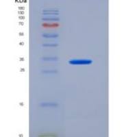 人Follistatin / FST (FS288)重组蛋白His tag