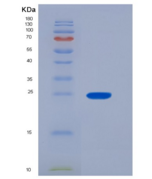 人磷酸丝氨酸性磷酸酶(PSPH)重组蛋白