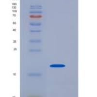 人Dim2 / TXNL4B重组蛋白His tag