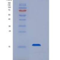 小鼠CD79B / B29重组蛋白His tag