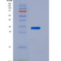 人DNASE1 / Deoxyribonuclease I / DNL1重组蛋白His tag