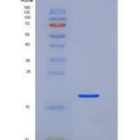 人肌钙蛋白C/TN C1重组蛋白