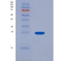 人磷酸丝氨酸性磷酸酶(PSPH)重组蛋白