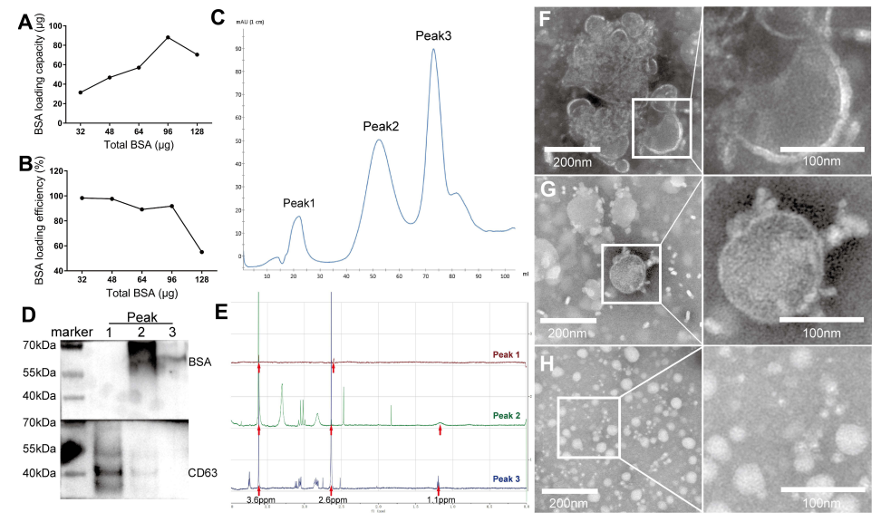 图一：（A）负载能力；（B）负载效率；（C）FPLC图谱结果；（D）Western blot结果；（E）NMR图谱结果；（F）透射电镜结果。