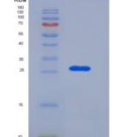 人RPE / RPE2-1重组蛋白His tag