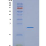 人TMEM25重组蛋白His tag
