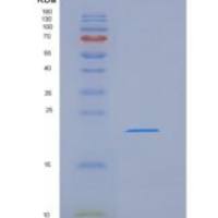 人TMEM25重组蛋白His tag