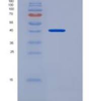 大鼠CD164 / Endolyn重组蛋白Fc tag