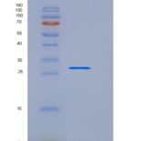 人TWF1 / PTK9 / Twinfilin-1重组蛋白