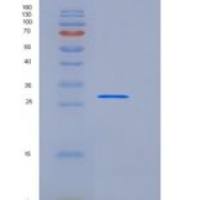 人TWF1 / PTK9 / Twinfilin-1重组蛋白