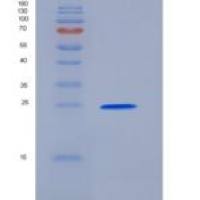 人IGSF11 / BTIGSF重组蛋白His tag