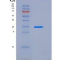 人Carbonic Anhydrase VB / CA5B重组蛋白His tag