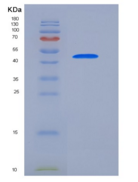 人细胞周期蛋白E1重组蛋白