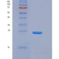 人CD32B重组蛋白His &AVI Tag, Biotinylated