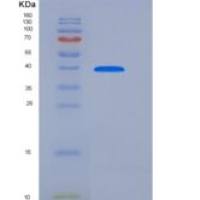 人HAPLN1重组蛋白His tag