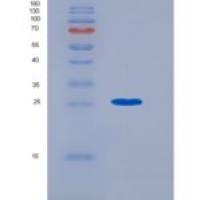 人胰蛋白酶-3 / PRSS3重组蛋白His tag