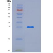 小鼠柯萨奇病毒腺病毒受体(CXADR)重组蛋白His tag