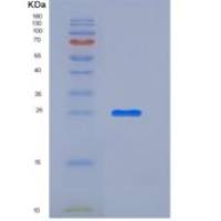 小鼠柯萨奇病毒腺病毒受体(CXADR)重组蛋白His tag