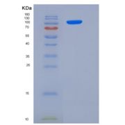 人Jagged 1重组蛋白His Tag