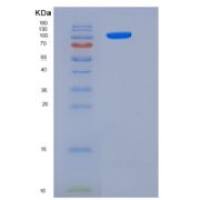 人Jagged 1重组蛋白His Tag