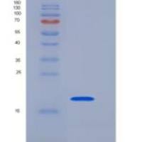人CD153 / CD30L / TNFSF8重组蛋白