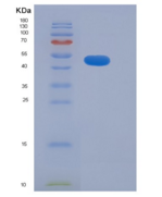 人解整合素金属蛋白酶15(ADAM15)重组蛋白His ta