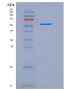 人IL17RA / CD217重组蛋白His & Fc ta
