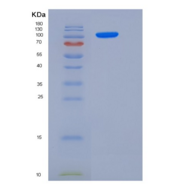 人Jagged 1重组蛋白His Tag