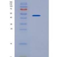 小鼠SLC3A2 / CD98重组蛋白His tag