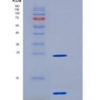 人S100A11 / S100C重组蛋白