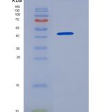 人GOLM1 / GP73重组蛋白His tag