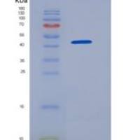 人GOLM1 / GP73重组蛋白His tag