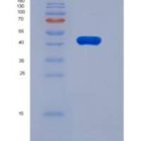 大鼠羧肽酶B2(CPB2)重组蛋白His Tag