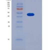 人SMYD2 / KMT3C重组蛋白His tag