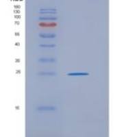小鼠糖蛋白A33(GPA33)重组蛋白His tag