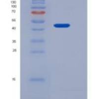 人AMIGO2重组蛋白His tag