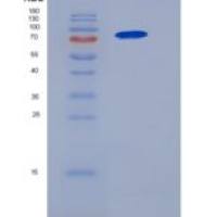 人NCF-2 / NCF2 / P67phox重组蛋白His & GST tag