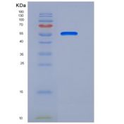人TEM8重组蛋白Fc Tag