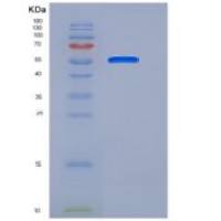 人TEM8重组蛋白Fc Tag