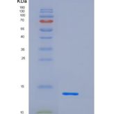 小鼠CD83分子(CD83)重组蛋白His Tag