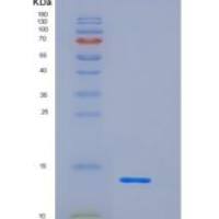 小鼠CD83分子(CD83)重组蛋白His Tag