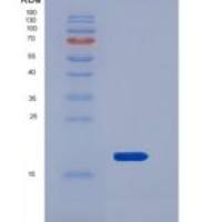 小鼠REG3B / Pap1重组蛋白His tag